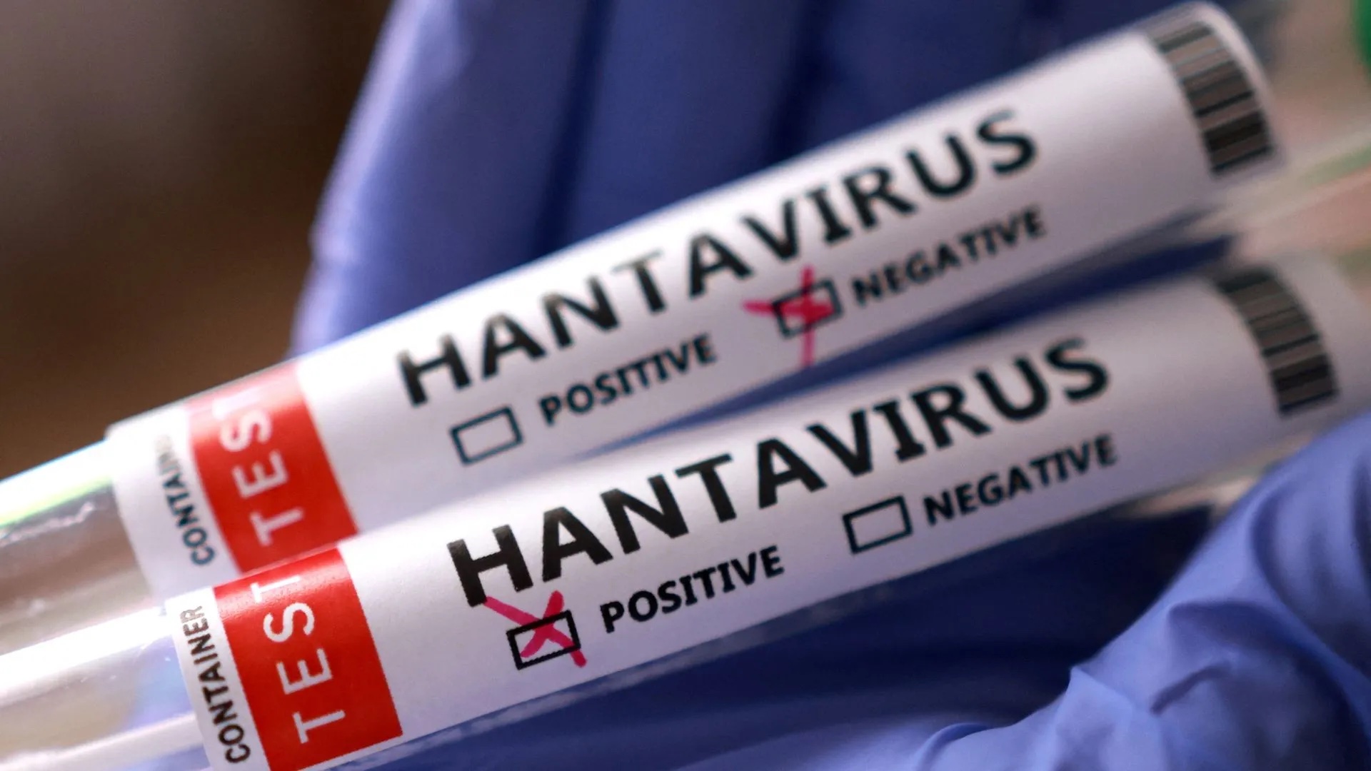 Un pasajero espa&ntilde;ol aislado en el G&oacute;mez Ulla da positivo por hantavirus