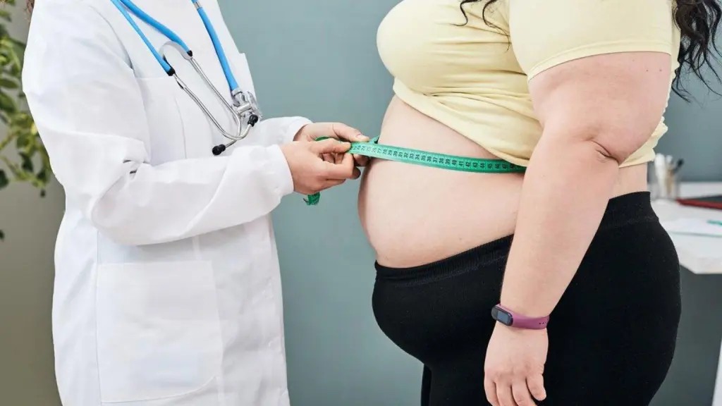 La obesidad cuesta 327.5 millones de euros a Canarias